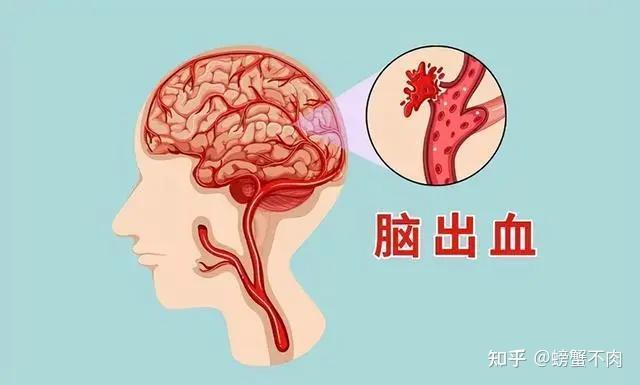 高血压的危害你注意了吗？